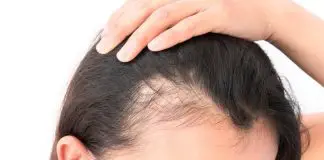 Top 10 Hair Loss Treatment Centres in KL & Selangor