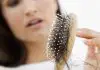 Top 10 Hair Loss Treatment Centres in Singapore
