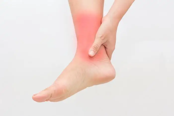Reason To Skip Flip-Flops #3: You Might Sprain Your Ankle