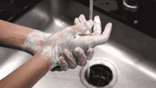 Hand Burn Home Remedy: Mild Soap & Water
