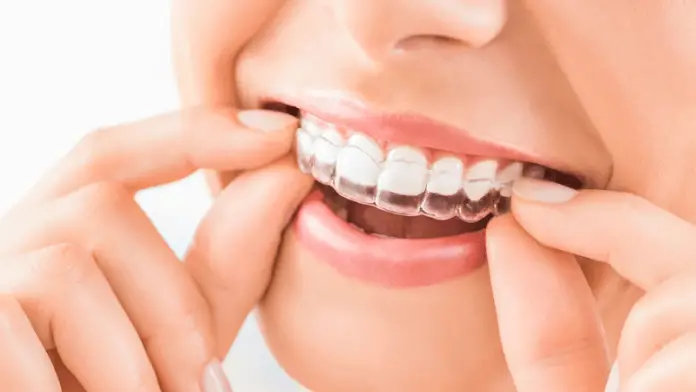 Top 10 Clinics for Invisalign in Singapore